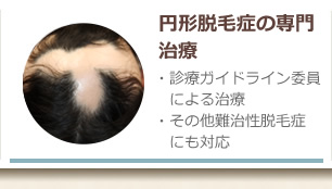 円形脱毛症の専門治療