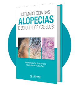 livro-dermatologia-das-alopecias